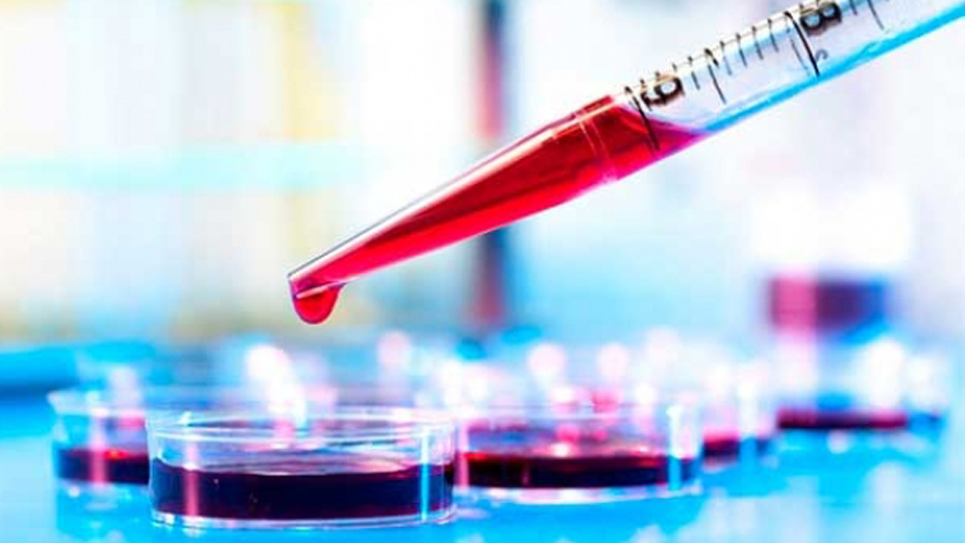 La biopsia líquida está en etapa de perfeccionamiento, aunque ya se aplica