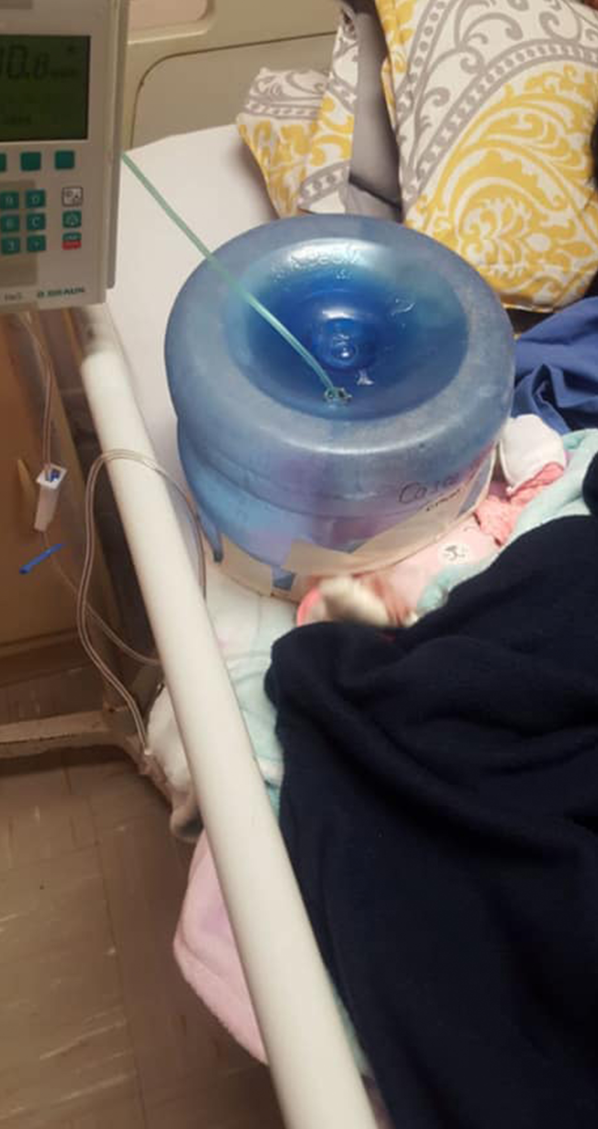 Tras el caso denunciado por Noemí Hernández de Valdivia, otra señora aseguró que a su hijo también le pusieron un garrafón como respirador (Foto: Facebook Noemí Hernández de Valdivia)