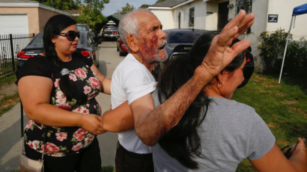 Rodolfo Rodríguez fue atacado el 4 de julio mientras caminaba por el barrio de Willowbrook (Foto: AP)