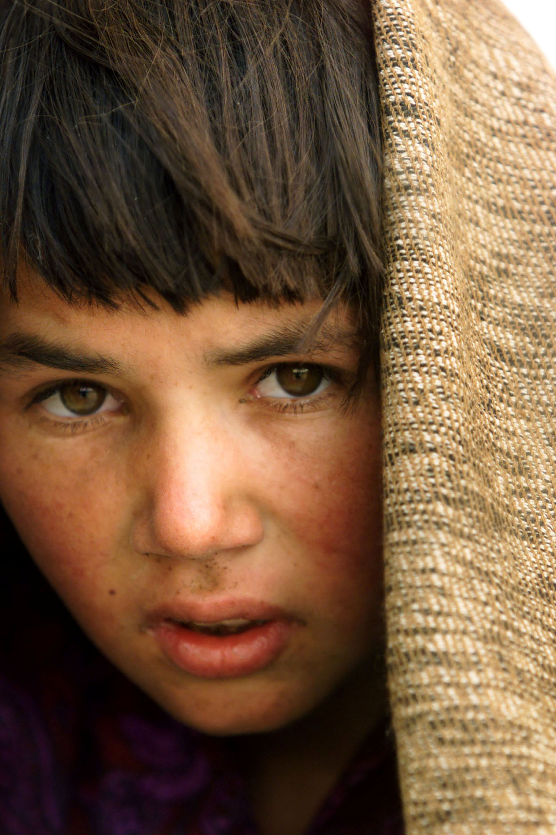 Habiba, de 12 años, espera para recibir tratamiento por osteomielitis a 60 kilómetros de Kabul (Afganistán), en octubre de 2001