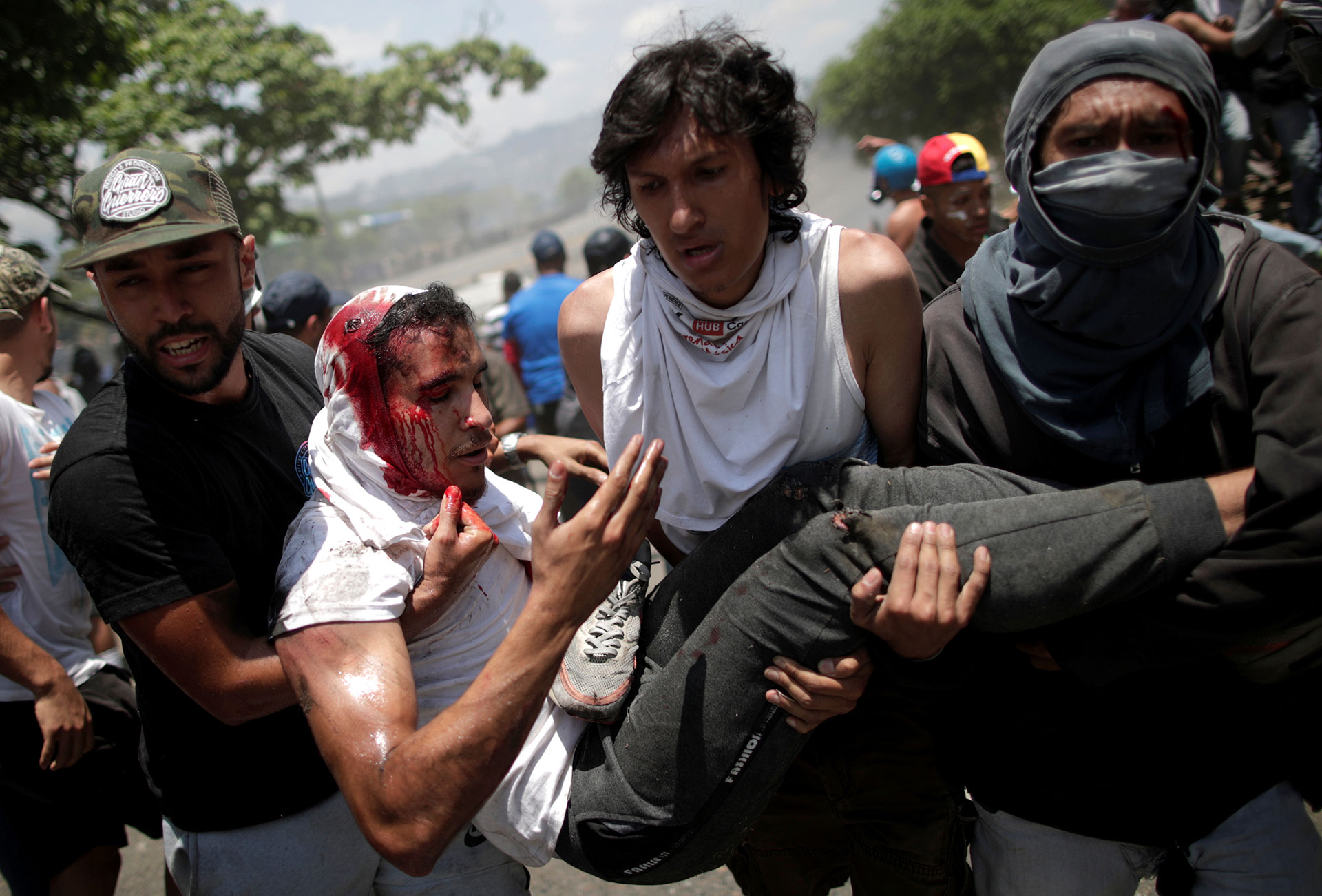 Un manifestante herido es trasladado luego de haber sido atropellado por un vehículo de la Guardia Nacional de Venezuela en los alrededores de la base aérea Generalisimo Francisco de Miranda “La Carlota” en Caracas.