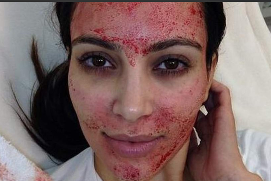 En el 2013 se realizó este facial Kim Kardashian (Foto: Instagram)