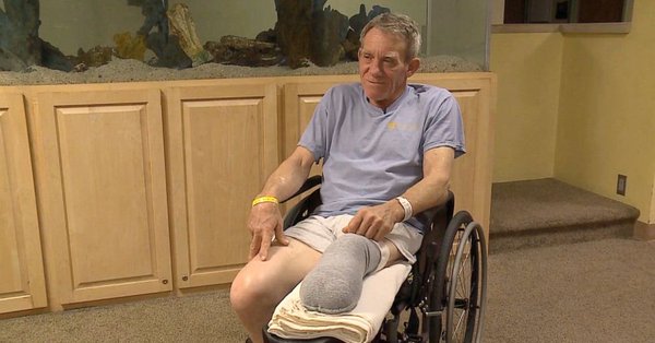 Kurt Kaser se recupera y continúa su terapia para poder usar una prótesis (cortesía KETV)