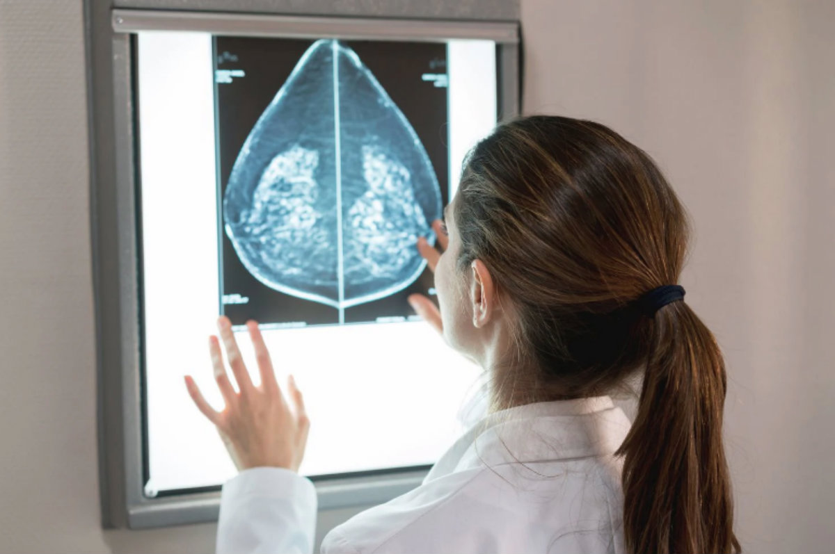 Comer bien puede reduce el riesgo de morir de cáncer (Foto: Washington Post)