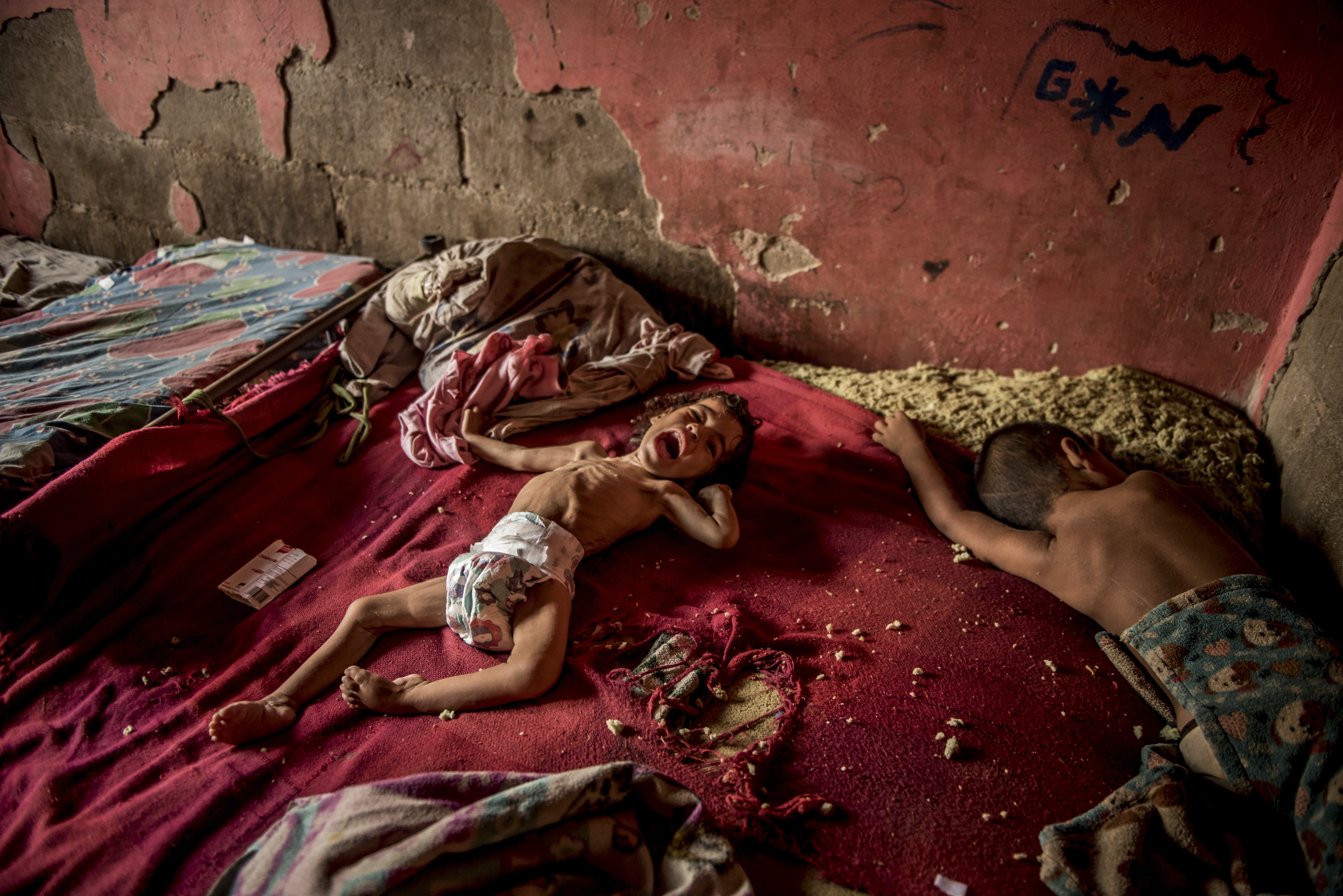 El hospital de la Isla de Toas está vacío, su último paciente murió sin recibir cuidados médicos. Cerca de esa institución de salud, Anailin, una niña de dos años de edad, sufre desnutrición severa y una parálisis muscular tratable. (Meridith Kohut/The New York Times)