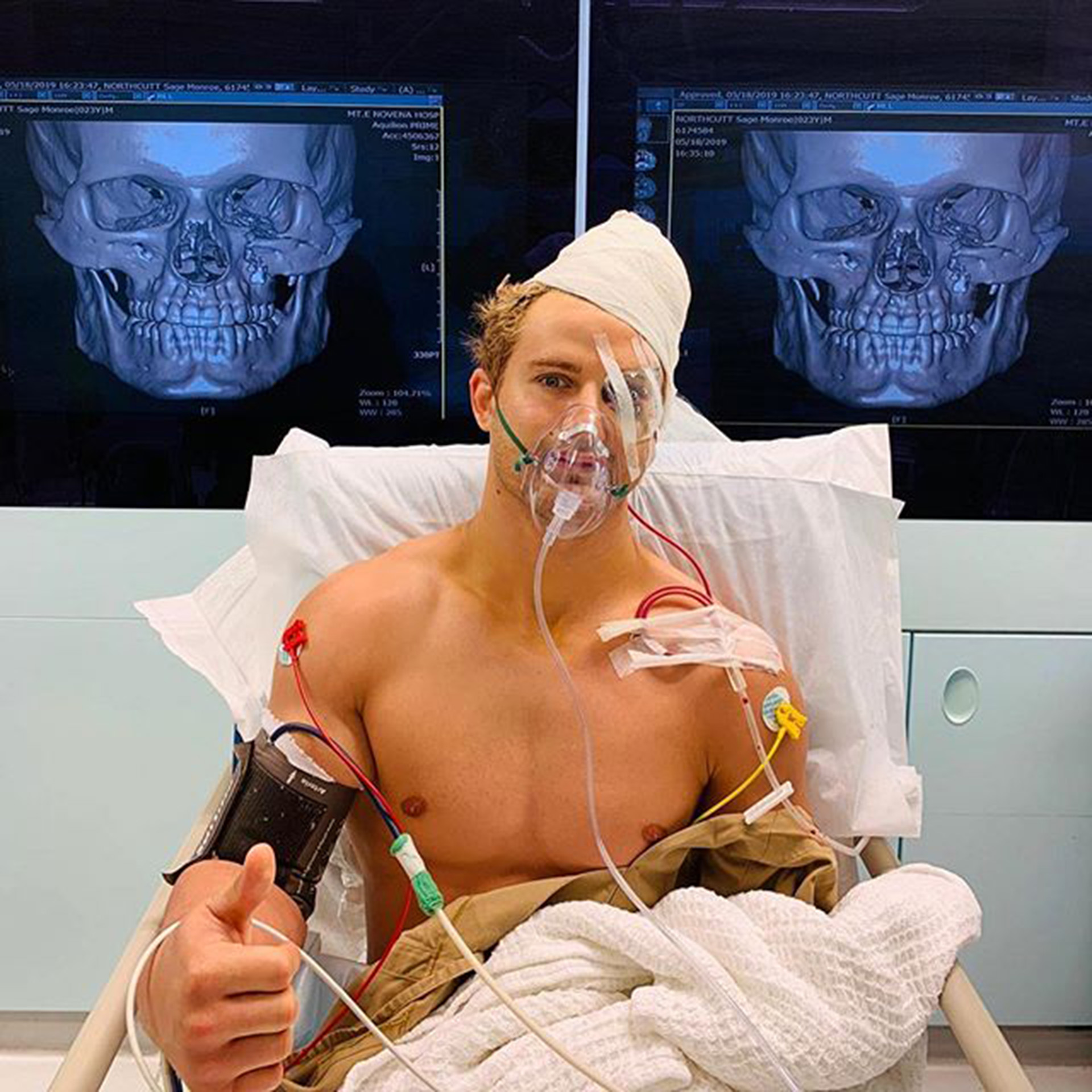 El feroz golpe que dejó a un luchador con ocho fracturas en el rostro