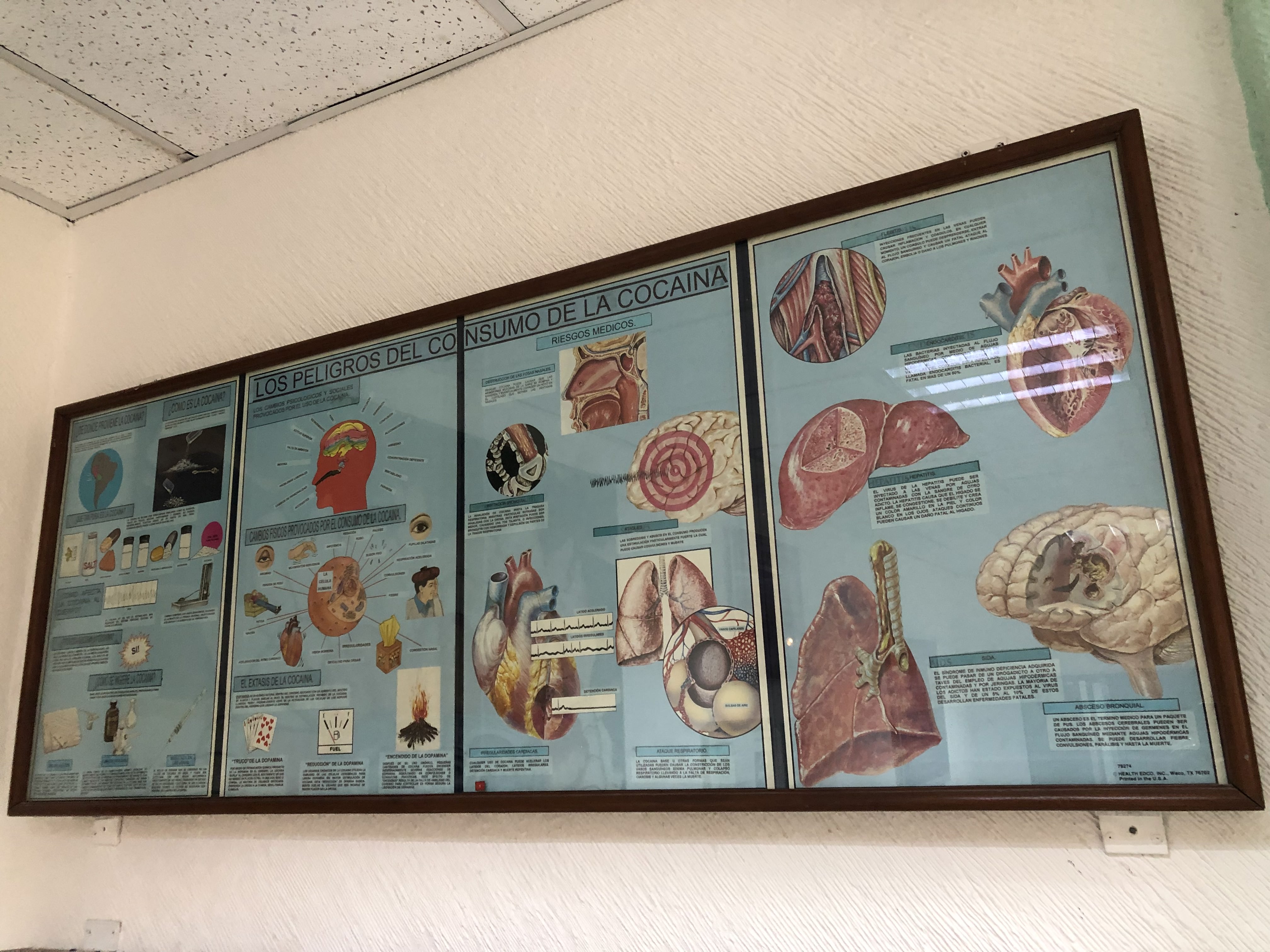En el Museo de los Enervantes se intenta advertir sobre el daño de las drogas al cuerpo (Foto: Diana Zavala/Infobae)