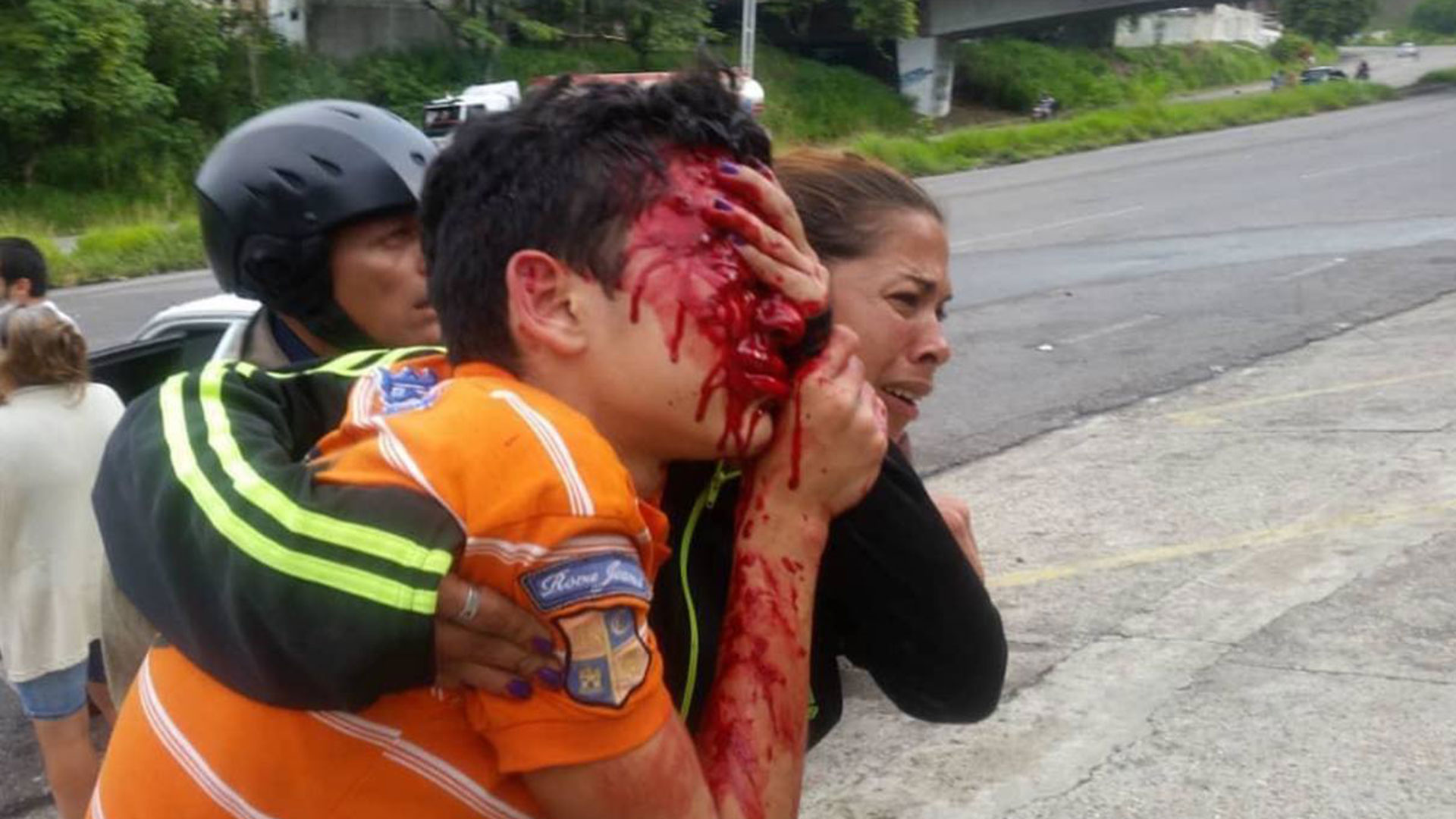 Rufo Chacón perdió los ojos a causa de la represión