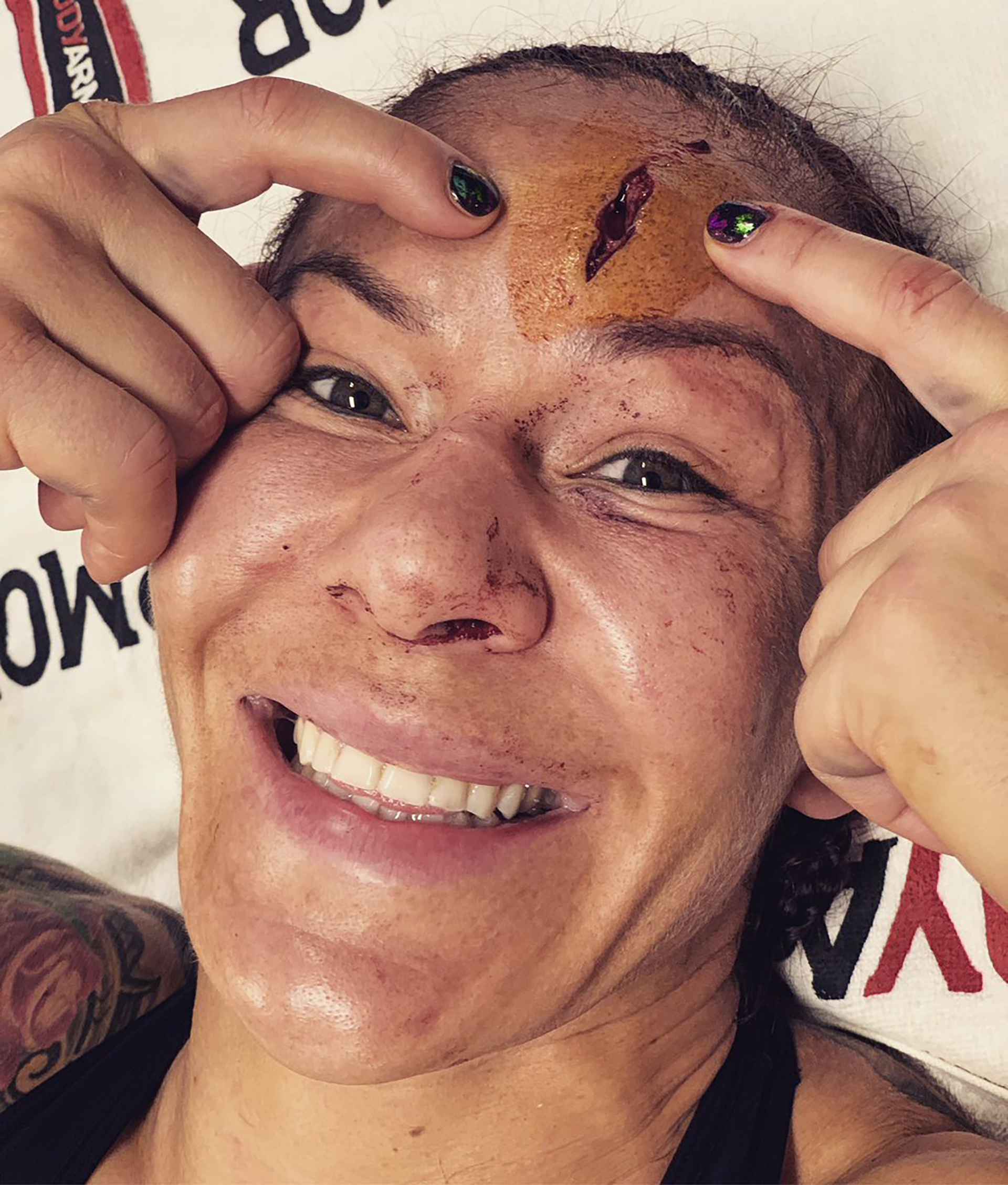 La impactante imagen de la frente de Cyborg (@criscyborg)