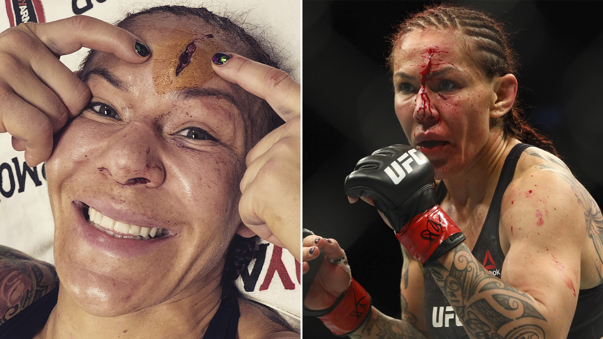 Así quedó el rostro de Cyborg tras la pelea
