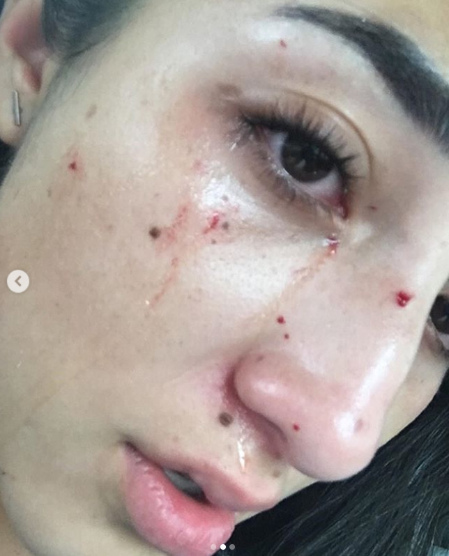 Después del hecho su mamá la llevó al hospital (Foto: Instagram)