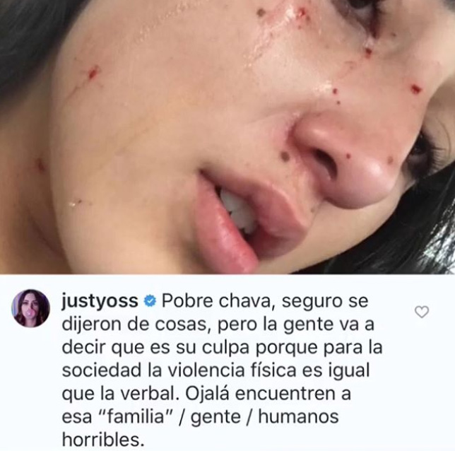 En redes sociales apoyan a Viviana del hecho que vivió (Foto: Instagram)