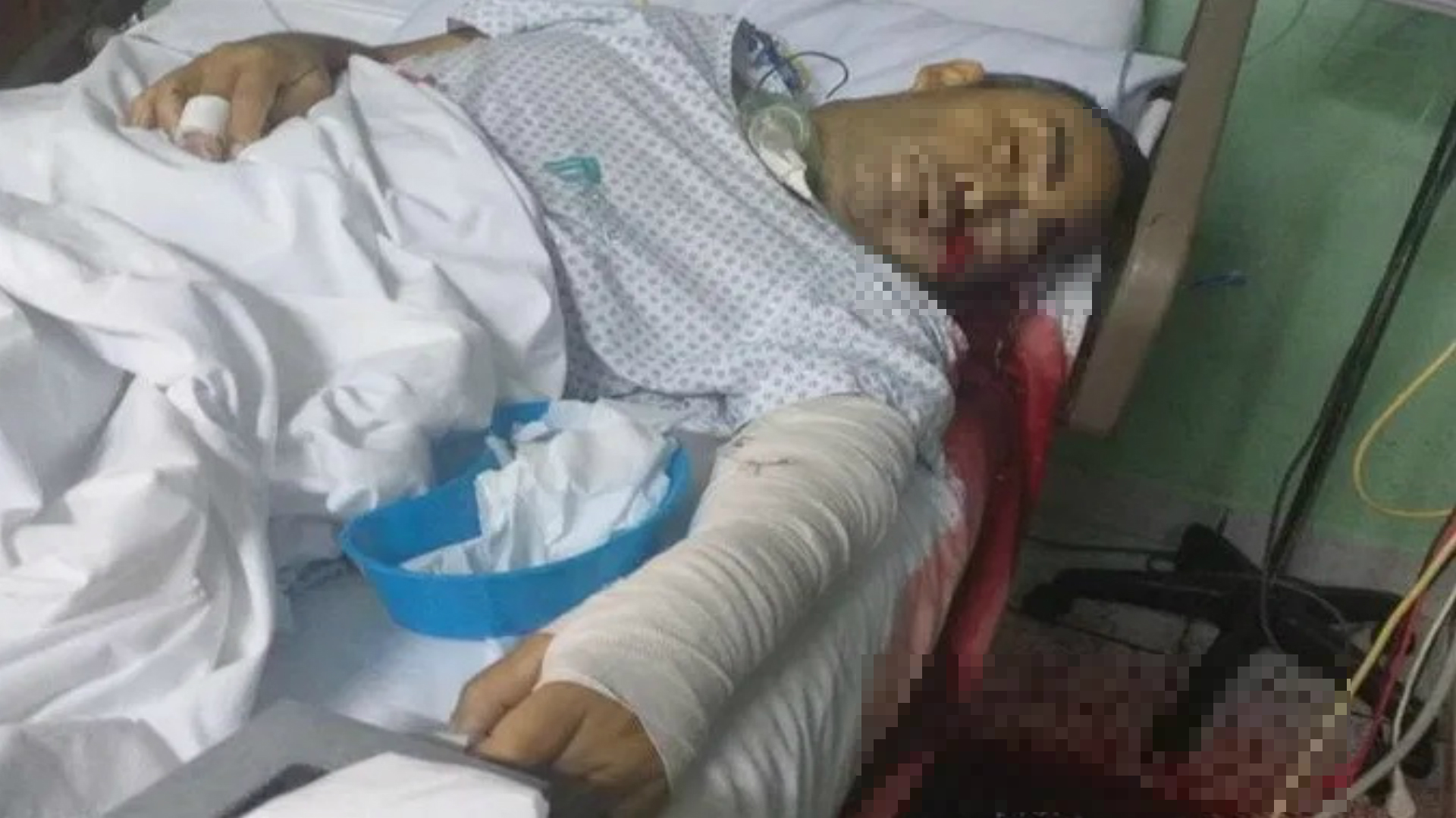 El narcotraficante fue ejecutado mientras se recuperaba de las heridas de un atentado (Foto: especial)