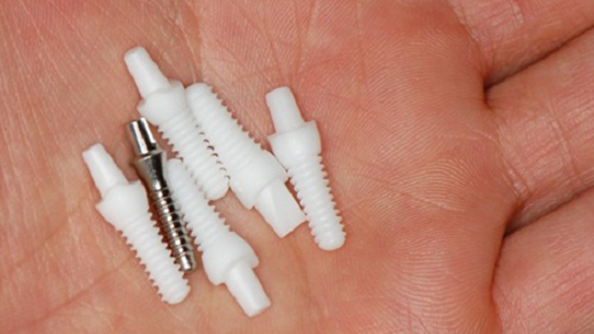 Estas piezas MABB representan lo último en implantes odontológicos. La compañía MABB creó un proyecto con criterios serios de sustentabilidad. Se trata de proyecto con alto impacto social, “que en un hospital público cualquiera pueda colocarse un implante cerámico de primera gama”, reforzó Miguez.
