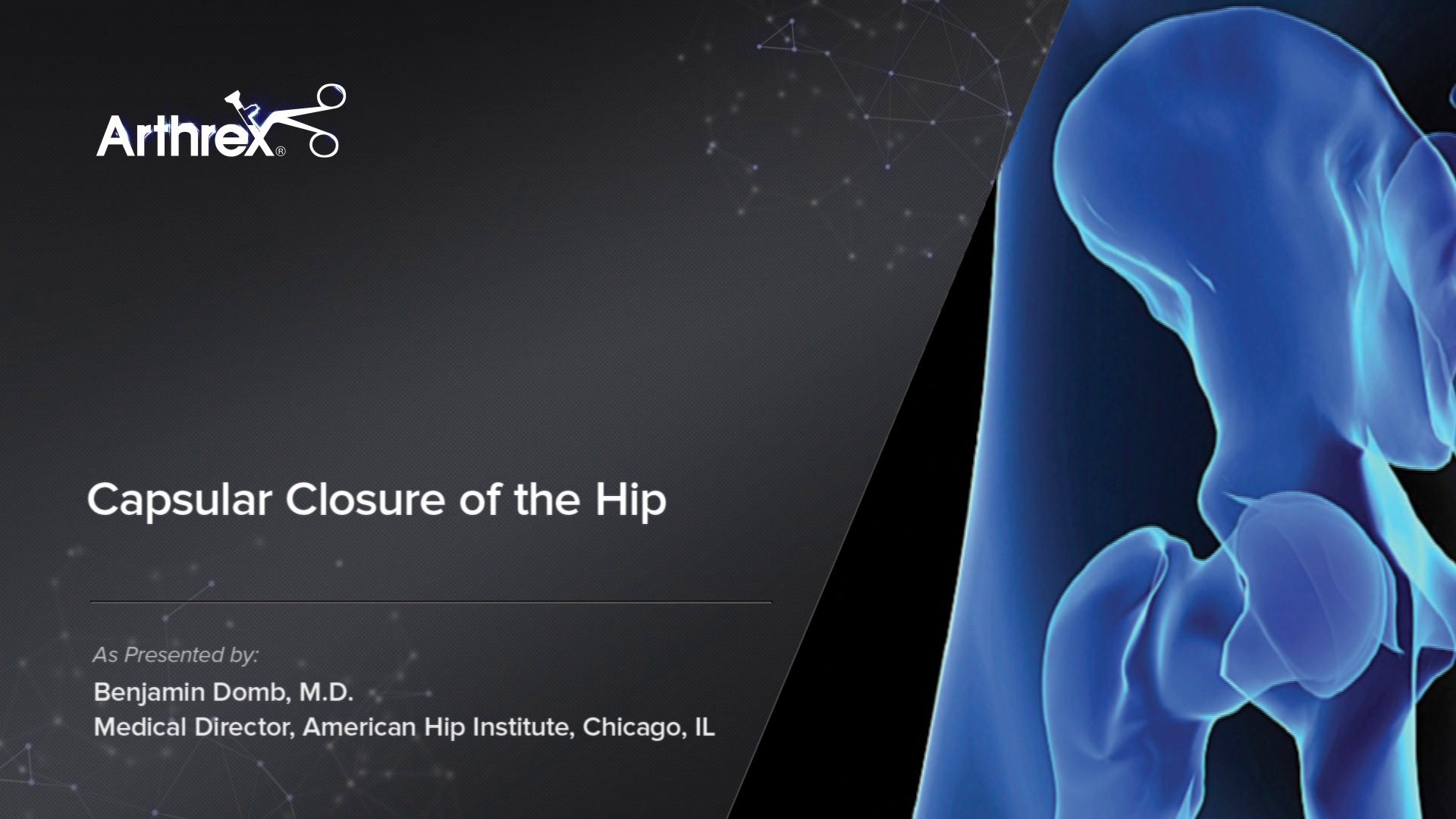 Arthrex Capsular Closure of the Hip Surgical Technique