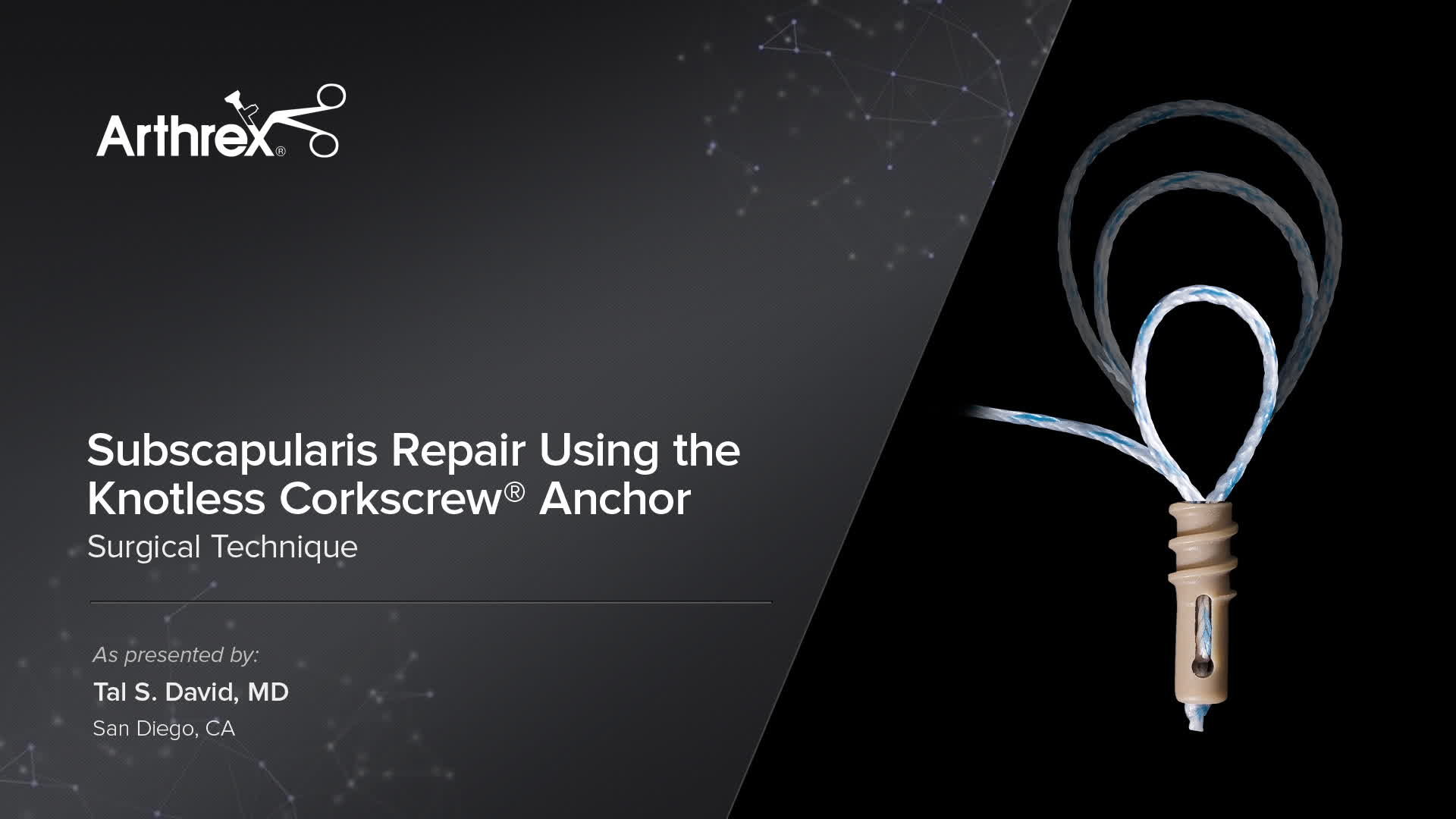 Arthrex Subscapularis Repair Using the Knotless Corkscrew® Anchor