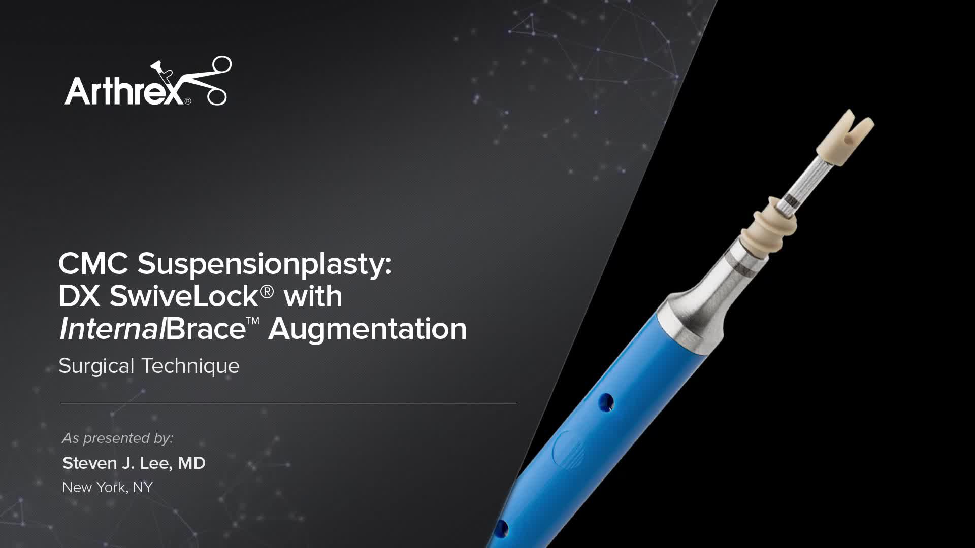 Arthrex CMC Suspensionplasty Using DX SwiveLock® With InternalBrace