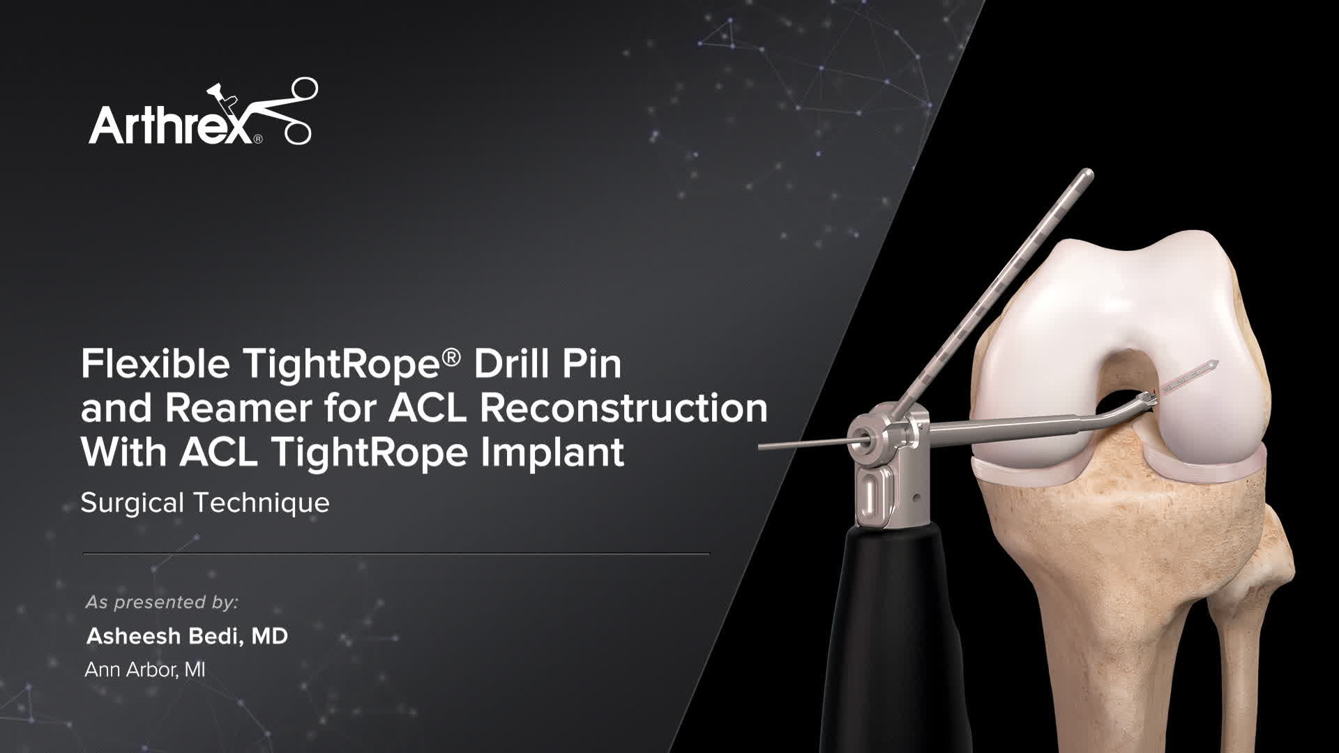 Arthrex Flexible TightRope® Drill Pin and Reamer for ACL