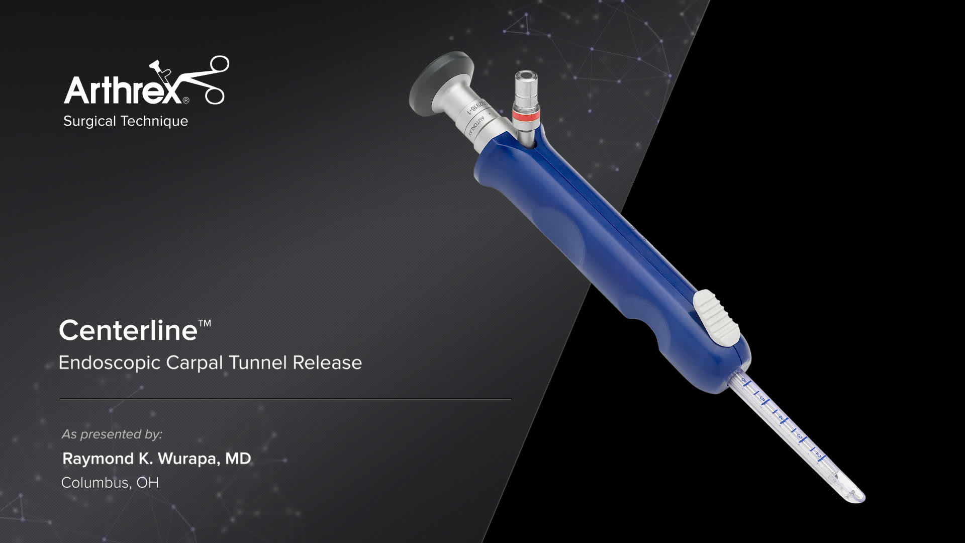 Arthrex Centerline™ Endoscopic Carpal Tunnel Release