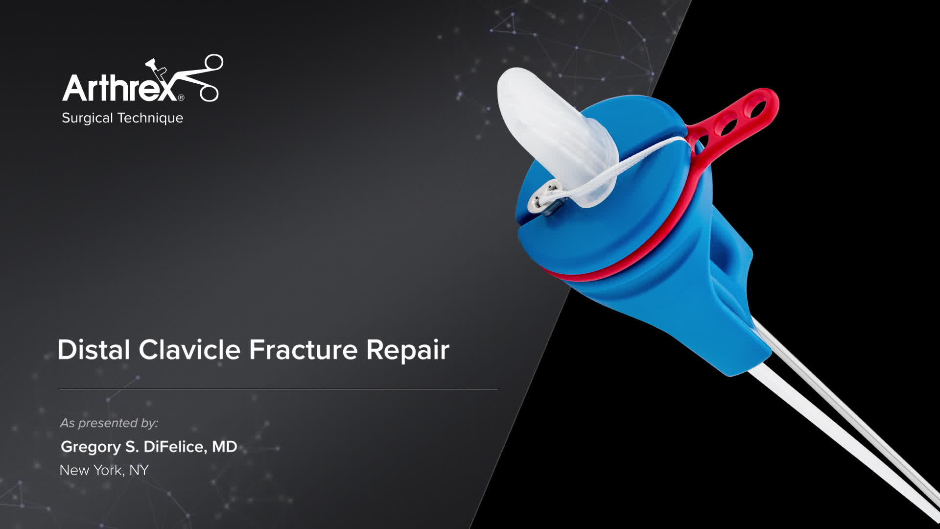 Arthrex Clavicle Plate , Clavicle Plate and Screw System Surgical ...