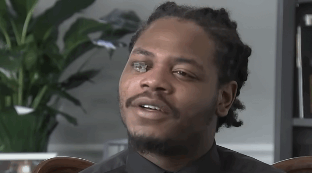 Chicago Black Man’s Face is Forever Changed After Being Tased By Police, But That’s Not the Worst Part…