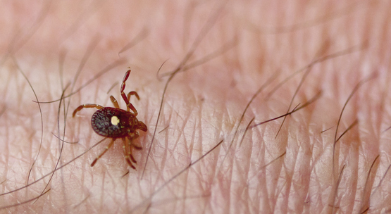 tick crawling on a persons arm