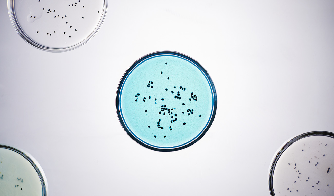 Placas de cultura com colônias bacterianas em meio de ágar; é em culturas assim que ocorre a síntese descrita no estudo. (imagem: Seventyfour / Adobe Stock)