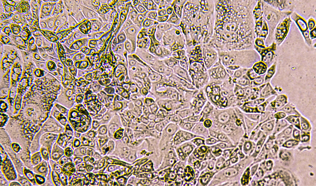 Un estudio señala que la relación T1/T2 es una herramienta poderosa para medir el riesgo en los astrocitomas. (imagen: sergunt / iStock)