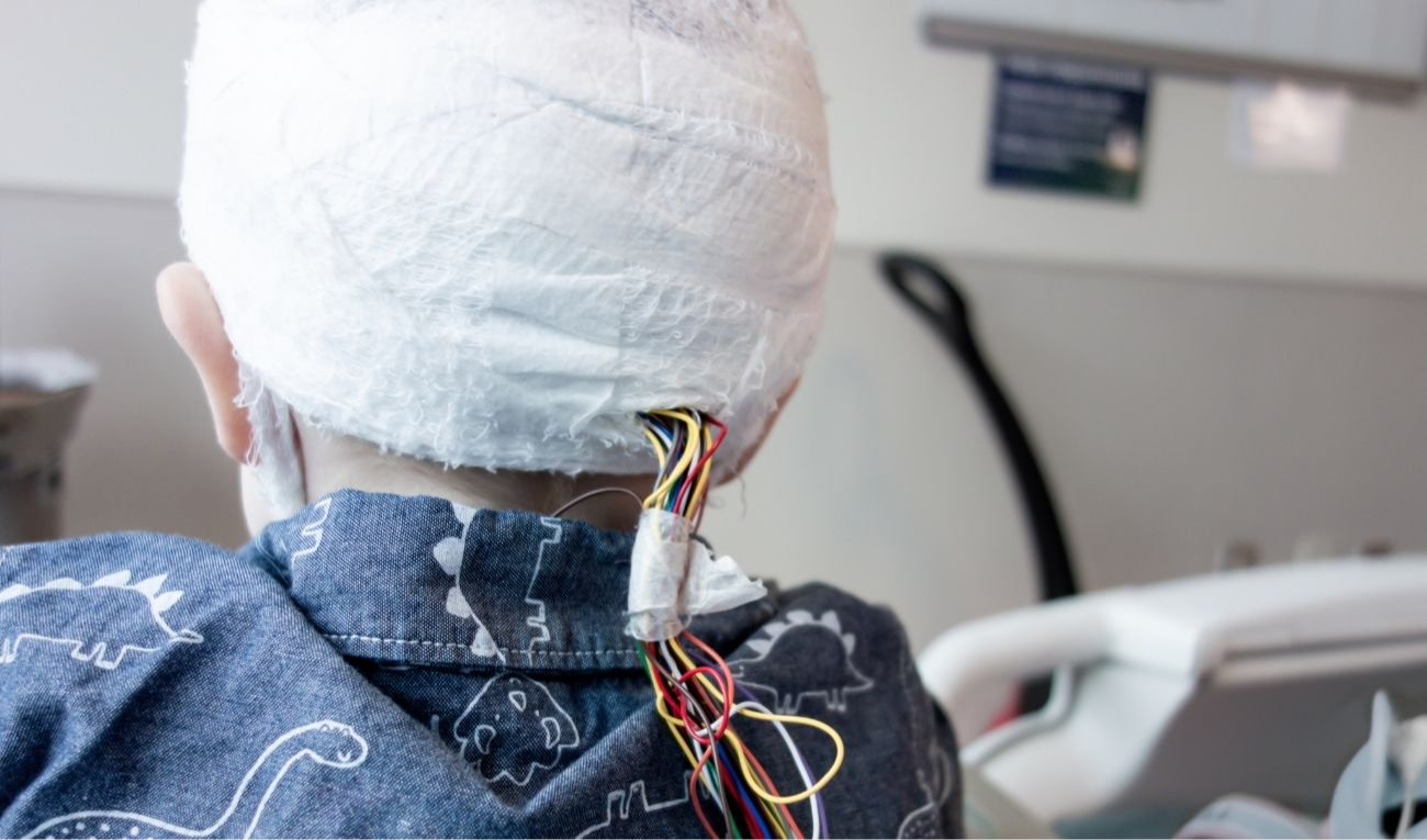 Los tumores cerebrales pediátricos de bajo grado son propensos a causar epilepsia intratable. (imagen: GrabillCreative / Getty Images)