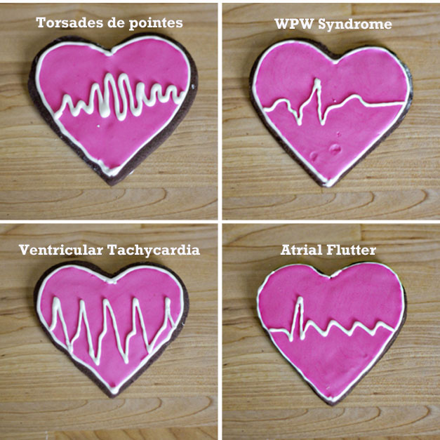 Photo: ECG Cookies