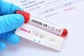 Rapid COVID Test
