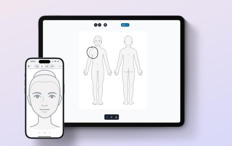 Exciting News: Introducing Annotations in OvatuNext! 🎨