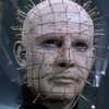Acupuncture