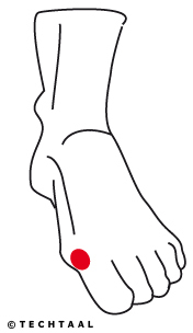 Maagvuur, brandend maagzuur