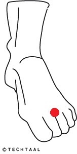 Maagvuur, brandend maagzuur