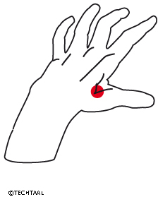 Maagvuur, brandend maagzuur