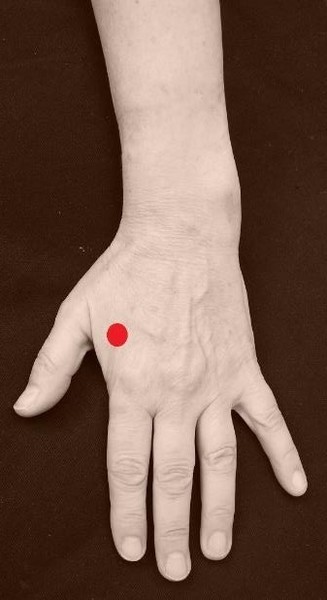 De punten voor algemene ondersteuning