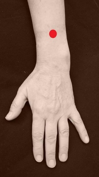 De punten voor algemene ondersteuning