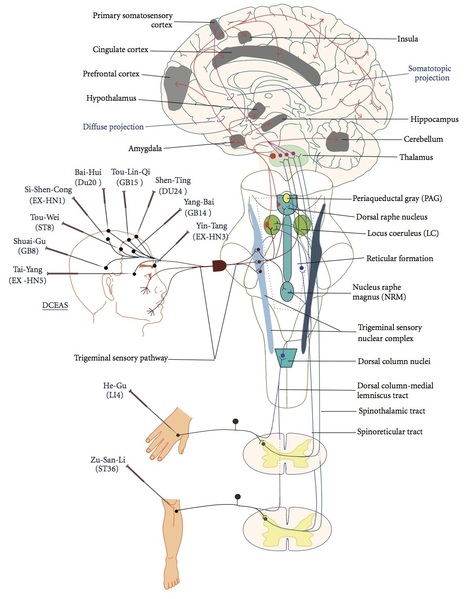 Acupunctuur bij pijn
