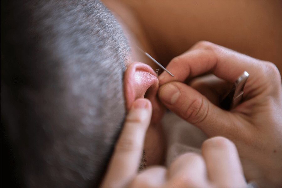 The Acupuncturist's Toolbox - Paul Heijer on Ear Acupuncture