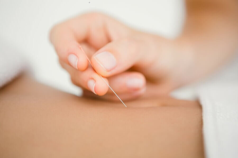 De gereedschapskist van de acupuncturist - Liesbeth Kerkhoff  over de Japanse acupunctuurstijl van dr. Manaka