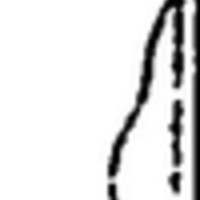 "Mind the trees!" (Novomoskovsk)