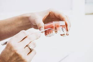 tooth implant 