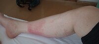 IMG_20260415_081024914
