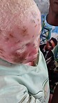 Wat 1 week geen crème doet met de huid