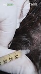 YTDown.com_Shorts_Is-Hair-PRP-the-Secret-to-Thicker-Health_Media_7cBJ1YAdES8_001_1080p