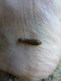 leech