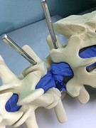 saw bone spine with blue dura