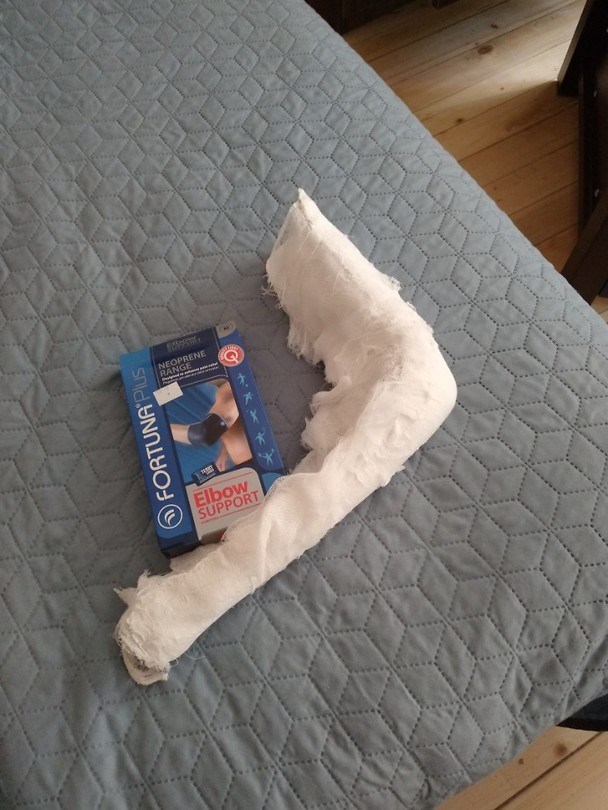 Gipsarm is niet meer, zijn opvolger elleboogbracelet