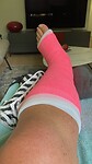 Echt Amstelveens gips